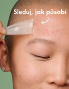 Hero Cosmetics Mighty Patch XL plasturi pentru piele problematică 10 buc