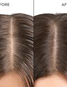 KERASILK Specialists Exfoliating Scalp & Hair Treatment tratament pre-sampon cu efect de exfoliere 200 ml