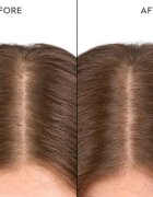 KERASILK Specialists Moisturizing Scalp Drops picături pentru scalp sensibil si uscat 100 ml