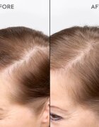 KERASILK Specialists Redensifying Scalp Serum ser de păr pentru a restabili densitatea parului 100 ml
