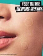 Kiehl's Truly Targeted Overnight Blemish Patch plasturi pentru piele problematică pentru femei 22 buc