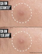 Kiehl's Truly Targeted Overnight Blemish Patch plasturi pentru piele problematică pentru femei 22 buc