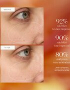 Kora Organics Turmeric Glow Drops ser cu efect iluminator cu niacinamidă 10 ml