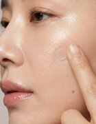 KORIKA Skin Essentials Microneedle Trouble spot patches plasturi pentru piele problematică impotriva acneei 9 buc