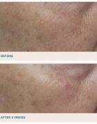 LANCER GRAVITY DARK SPOT CORRECTING SERUM ser impotriva petelor intunecate 30 ml
