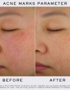 Lancôme Clarifique Refining Brightening Pro-Solution ser cu efect iluminator 50 ml
