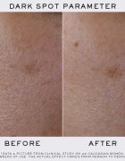 Lancôme Clarifique Refining Brightening Pro-Solution ser cu efect iluminator 50 ml