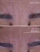 Lancôme Rénergie Collagen+ Lift-Xtend Cream cremă pentru față cu colagen 50 ml