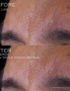 Lancôme Rénergie CRX Triple Serum Retinol ser facial 50 ml