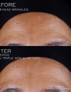 Lancôme Rénergie CRX Triple Serum Retinol ser facial 50 ml