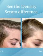 Living Proof Scalp Care ser pentru a restabili densitatea parului 50 ml