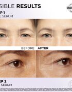L’Oréal Paris Revitalift Filler set pentru îngrijirea pielii pentru fata si zona ochilor