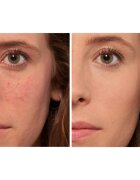 L’Oréal Paris True Match The One corector lichid culoare 1.R/C Rose Ivory 6.8 ml