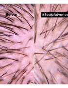 L’Oréal Professionnel Serie Expert Scalp Advanced ingrijire par pentru par si scalp 200 ml