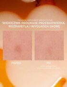 Lumene Nordic-C [VALO] Dark Spot Serum ser stralucire cu vitamina C impotriva petelor 30 ml