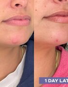 Mario Badescu Repairing Facial Spray With Hypochlorous Acid spray facial recuperator pentru netezirea pielii 118 ml