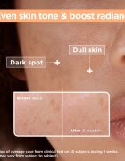 MIXA Anti-Dark Spot ser impotriva petelor 30 ml