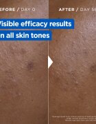 MIXA Niacinamide Bright cremă intens hidratantă impotriva petelor intunecate 400 ml
