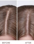 Moroccanoil Scalp Dry Scalp Treatment tratament nutritiv in profunzime pentru piele uscata 45 ml