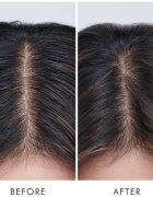 Moroccanoil Treatment Oily Scalp tratament pentru un scalp seboreic 45 ml