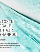 Nioxin System 3 Scalp + Hair Shampoo sampon de curatare pentru par vopsit 300 ml