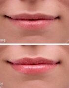 Notino Hydrating Sun Shield Lip Balm balsam de buze protector cu efect de hidratare SPF 30 10 ml