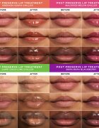 OLEHENRIKSEN Pout Preserve Chillers Passport To Chill set îngrijire buze