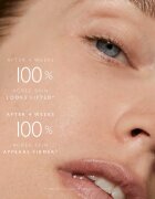 Omorovicza Queen Serum ser facial de intinerire 30 ml
