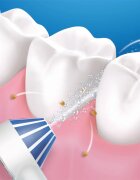 Oral-B Aquacare 4 dus bucal 1 buc