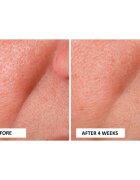 Perricone MD Cold Plasma Plus+ Advanced Serum ser hranitor faciale 30 ml