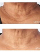 Perricone MD Cold Plasma Plus+ Sub-D/Neck Cremă fermitate gât și decolteu 59 ml