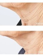 Perricone MD Cold Plasma Plus+ Sub-D/Neck Cremă fermitate gât și decolteu 59 ml