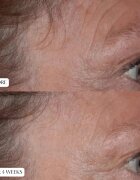 Perricone MD Cold Plasma Plus+ The Essence esenta faciala 140 ml