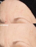 Perricone MD Cold Plasma Plus+ The Intensive Hydrating Complex crema intens hidratanta 30 ml