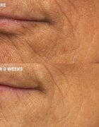 Perricone MD Cold Plasma Plus+ The Intensive Hydrating Complex crema intens hidratanta 30 ml