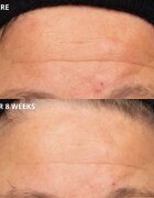 Perricone MD Cold Plasma Plus+ The Intensive Hydrating Complex crema intens hidratanta 30 ml
