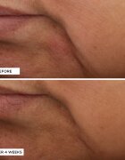 Perricone MD Essential Fx Acyl-Glutathione Moisturizer crema anti-rid hidratanta antirid 30 ml