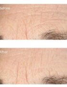 Perricone MD Essential Fx Acyl-Glutathione Serum ser hidratant efect intens anti-rid 30 ml