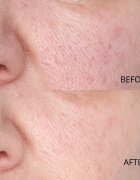 Perricone MD Hypoallergenic Clean Correction Smoothing Restorative Serum Ser hidratant de netezire pentru o piele mai luminoasă 59 ml