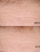Perricone MD Hypoallergenic Clean Correction Smoothing Restorative Serum Ser hidratant de netezire pentru o piele mai luminoasă 59 ml