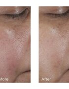 Perricone MD No:Rinse Pore Minimizing Toner tonic intens pentru netezirea pielii si inchiderea porilor 118 ml