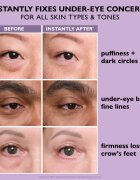 Peter Thomas Roth Instant FIRMx Eye crema de ochi pentru intinerirea pielii 20 ml