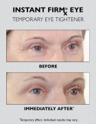 Peter Thomas Roth Instant FIRMx Eye crema de ochi pentru intinerirea pielii 30 ml