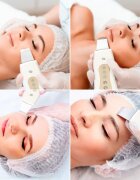 RIO Ultrasonic Facial dispozitiv de curatare a fetei 1 buc