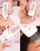 RIO Ultrasonic Facial dispozitiv de curatare a fetei 1 buc