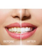 RIO USB teeth whitening Kit pentru albirea dinților