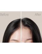 RYO Root:Gen Hair Loss Care Shampoo Sampon impotriva caderii parului pentru femei 353 ml