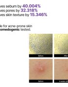 Some By Mi Retinol Intense Reactivating Serum ser antirid cu retinol pentru piele sensibilă 50 ml