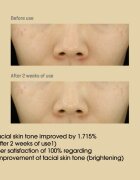 Some By Mi Yuja Niacin Anti Blemish Cream cremă de față pentru hidratare și iluminare pentru piele cu hiperpigmentare 60 g