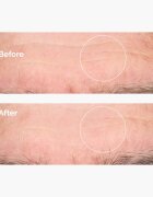 The Ordinary Hyaluronic Acid 2% + B5 ser hidratant cu ceramide 60 ml